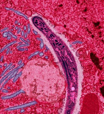 The malaria plasmodium.