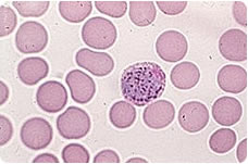 Malaria parasites destroy red blood cells