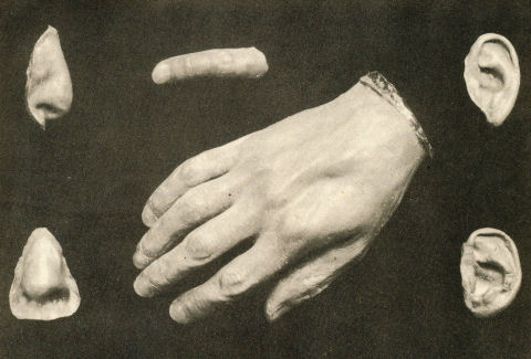 Prosthetic finger, hand and face features
