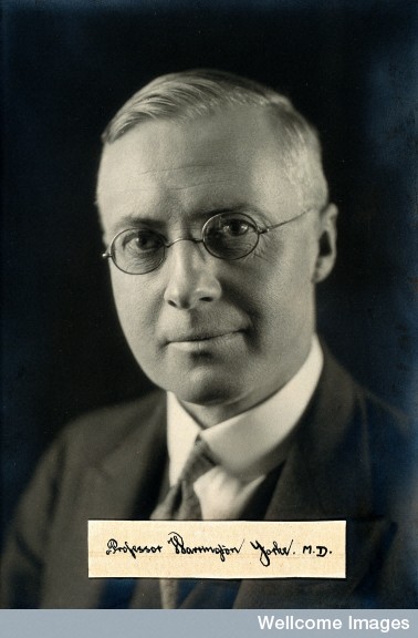 Prof Warrington Yorke Prof Warrington Yorke